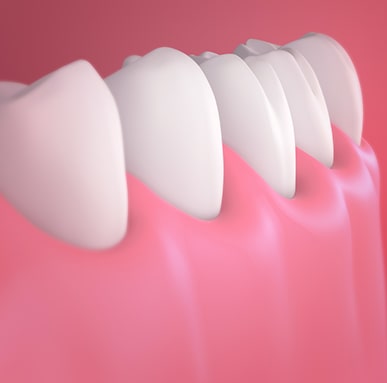 Treatment - Amery House Dental Practice