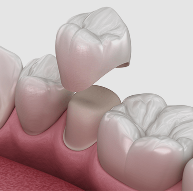 Treatment - Amery House Dental Practice