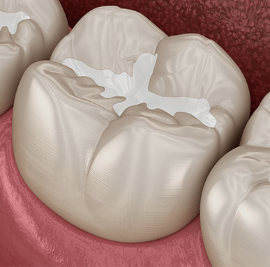 Treatment - Amery House Dental Practice