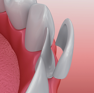 Treatment - Amery House Dental Practice