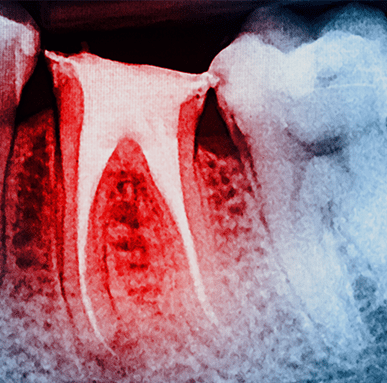 Treatment - Amery House Dental Practice