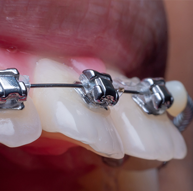 Treatment - Amery House Dental Practice