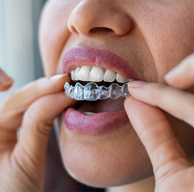 Treatment - Amery House Dental Practice